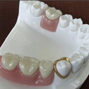 Точная привязанность